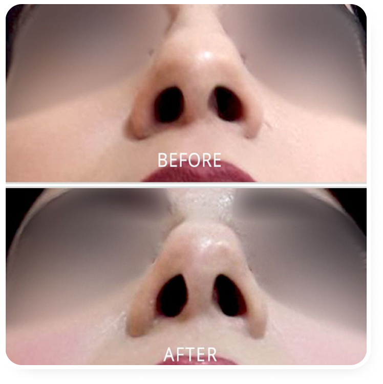 Resultado antes e depois
