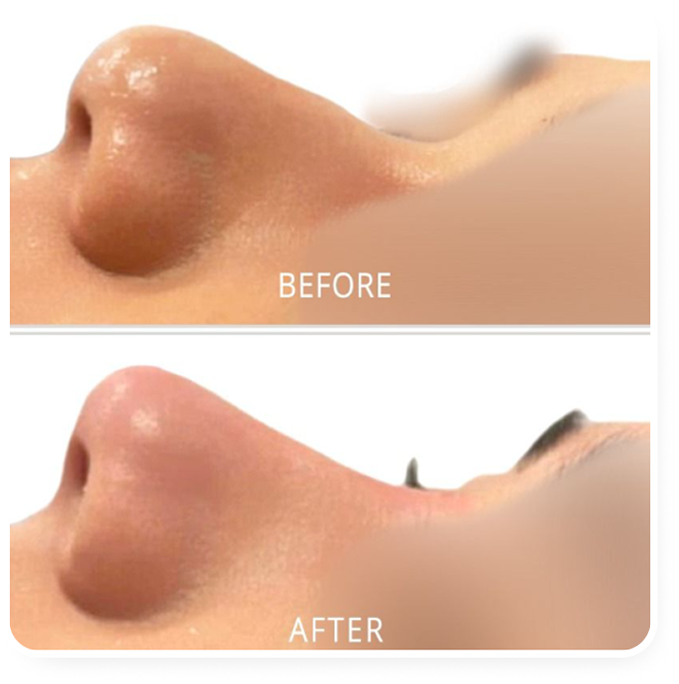 Resultado antes e depois