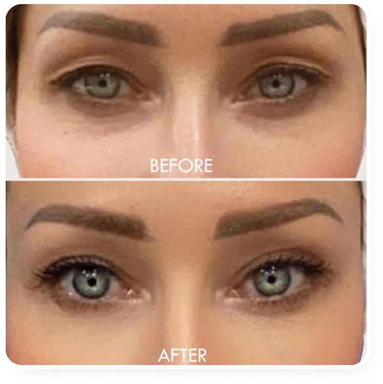 Resultado antes e depois